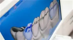 ##IMAGE##