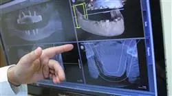 ##IMAGE##