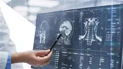 diplomado online optimizacion tratamiento cuidado paciente inteligencia artificial