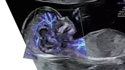 b learning enfermagem obstetrica Tech Universidad