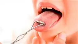 b learning neurorreabilitacao logopedica orofacial enfermeiros Tech Universidad