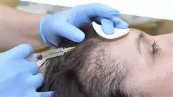 berufliche praktiken haartransplantation Tech Universidad