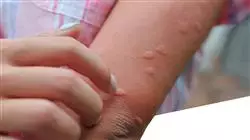 ##IMAGE##