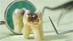 capacitacion practica posgrado endodoncia microcirugia apical Tech Universidad