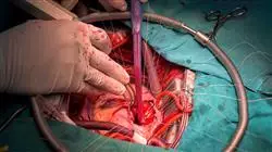 curso practicas cardiologia oncologica Tech Universidad