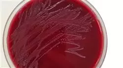 curso practicas enfermedades infecciosas servicio urgencias Tech Universidad