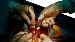 curso presencial cardiologia oncologica Tech Universidad