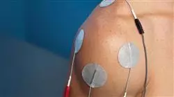 esperto universitario stimolazione elettrica correnti interferenziali fisioterapia Tech Universidad