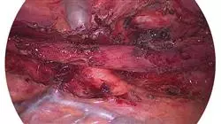 estagio avancos gastroenterologia hepatologia pediatrica medicina br Tech Universidad