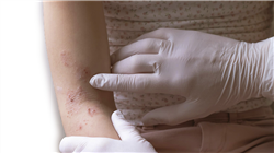 estudar dermatologia pediatrica Tech Universidad