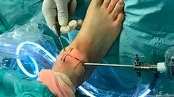 estudiar artroscopia pie tobillo TECH Global University