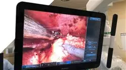 formacao b learning enfermagem oncologica pediatrica Tech Universidad