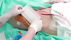 maestria actualizacion cirugia urologica Tech Universidad