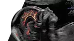 maestria obstetricia matronas Tech Universidad