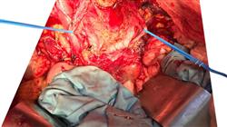 maestria oncologia medica Tech Universidad