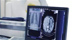 master actualizacion tecnicas diagnosticas terapeuticas radiologia Tech Universidad