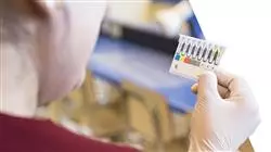 master avances ematologia emoterapia TECH Global University