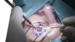 master degree macula retina vitreous pathology surgery Tech Universidad