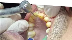 master dental prosthesis TECH Global University