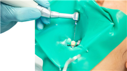 master endodontics apical microsurgery Tech Universidad