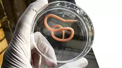 master enfermedades infecciosas servicio urgencias Tech Universidad