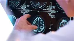 master infermieristica servizio neurologia Tech Universidad