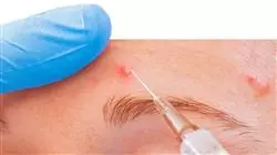 master master semipresenziale trattamento acne Tech Universidad