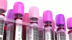 master medicina genomica precision hematologia trombosis Tech Universidad