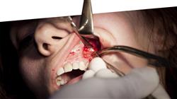 master medicina oral Tech Universidad