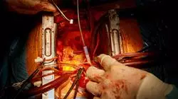 master misto cardiologia oncologica Tech Universidad