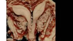 master obstetric nursing Tech Universidad