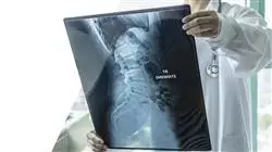 master oncologia radioterapica Tech Universidad