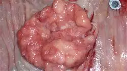 master online proctologia Tech Universidad