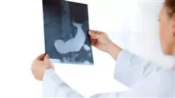 master patologia oncologica endocrina Tech Universidad