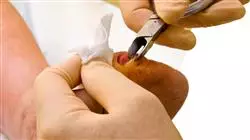 master podologia clinica avanzata Tech Universidad