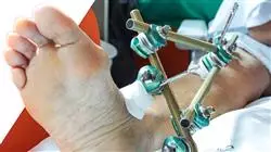 master tirocinio aggiornamento chirurgia ortopedica traumatologia Tech Universidad