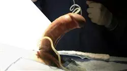 master tirocinio aggiornamento chirurgia urologica Tech Universidad