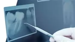 master tirocinio aggiornamento odontoiatria pediatrica Tech Universidad