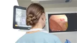master tirocinio epatologia Tech Universidad