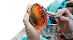 master tirocinio infettivologia clinica terapia antibiotica Tech Universidad