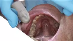 master tirocinio master semipresenziale odontoiatria pazienti bisogni specifici Tech Universidad