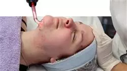 master tirocinio master semipresenziale trattamento acne Tech Universidad