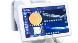 master tirocinio neuroftalmologia Tech Universidad