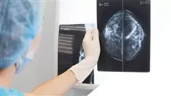 master tirocinio oncologia radioterapica Tech Universidad