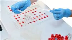 master tirocinio patologia tratto genitale inferiore hpv Tech Universidad