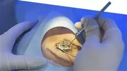 master tirocinio servizio oftamologia infermieristica Tech Universidad