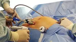 master update general digestive surgery Tech Universidad