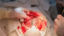 masterstudiengang neurochirurgie Tech Universidad
