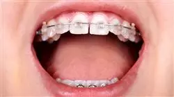 mejor maestria ortodoncia ortopedia dentofacial Tech Universidad