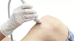 mestrado proprio ultrassonografia musculoesqueletica medicina reabilitacao medicina br Tech Universidad